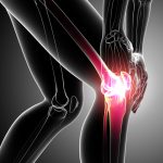 Best Orthopedic Surgeons