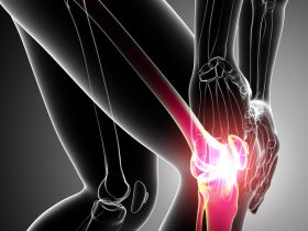 Best Orthopedic Surgeons