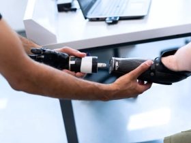 How Are Custom Prosthetics Made?